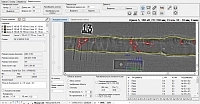 X-Vizor - ПО для компьютерной радиографии